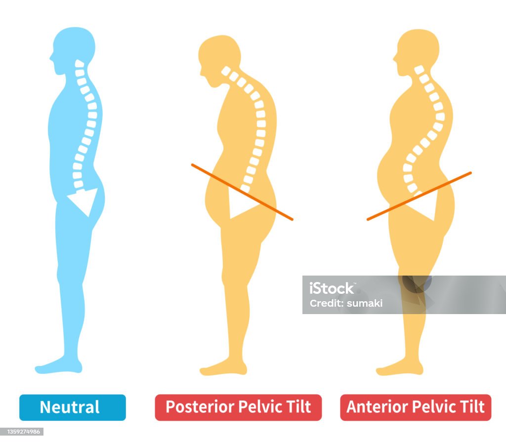 Illustration showing three body postures: Neutral posture on the left, Posterior Pelvic Tilt in the center, and Anterior Pelvic Tilt on the right, each labeled accordingly.